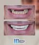 Slider image (8) IDC International Dental Clinic